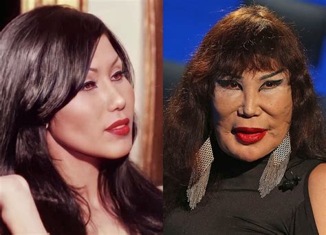 Lyn Mays Botched Plastic Surgeries Serve As A Stark。